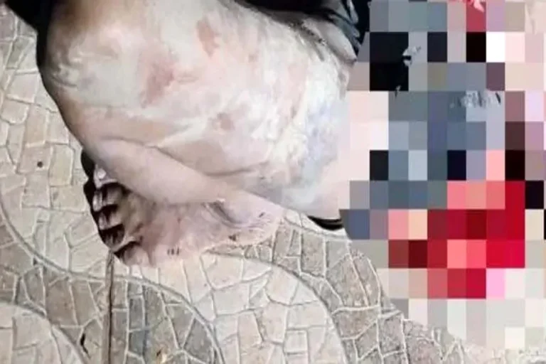 Mulher é atacada com várias facadas em Rondônia