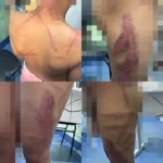 Menino de 9 anos é brutalmente espancado pelos próprios pais